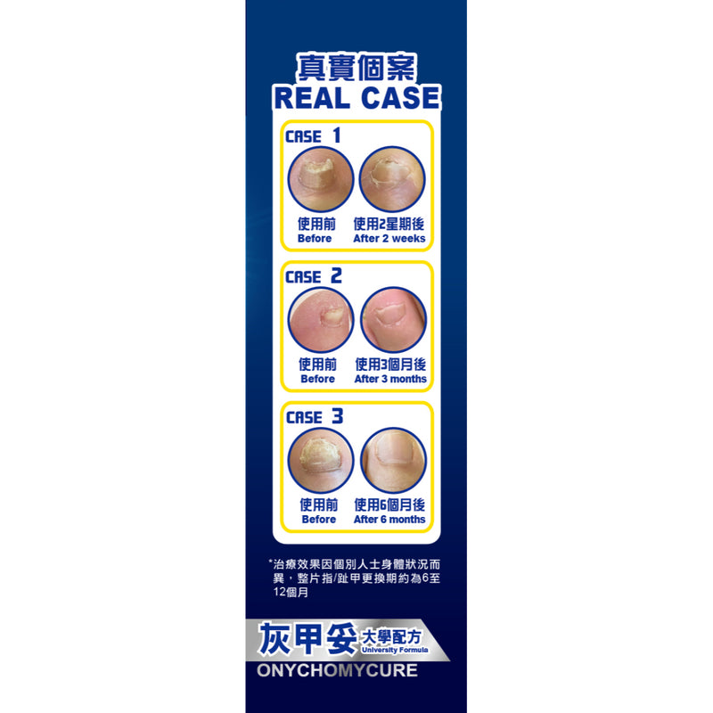 Noto Onychomycure 10ml